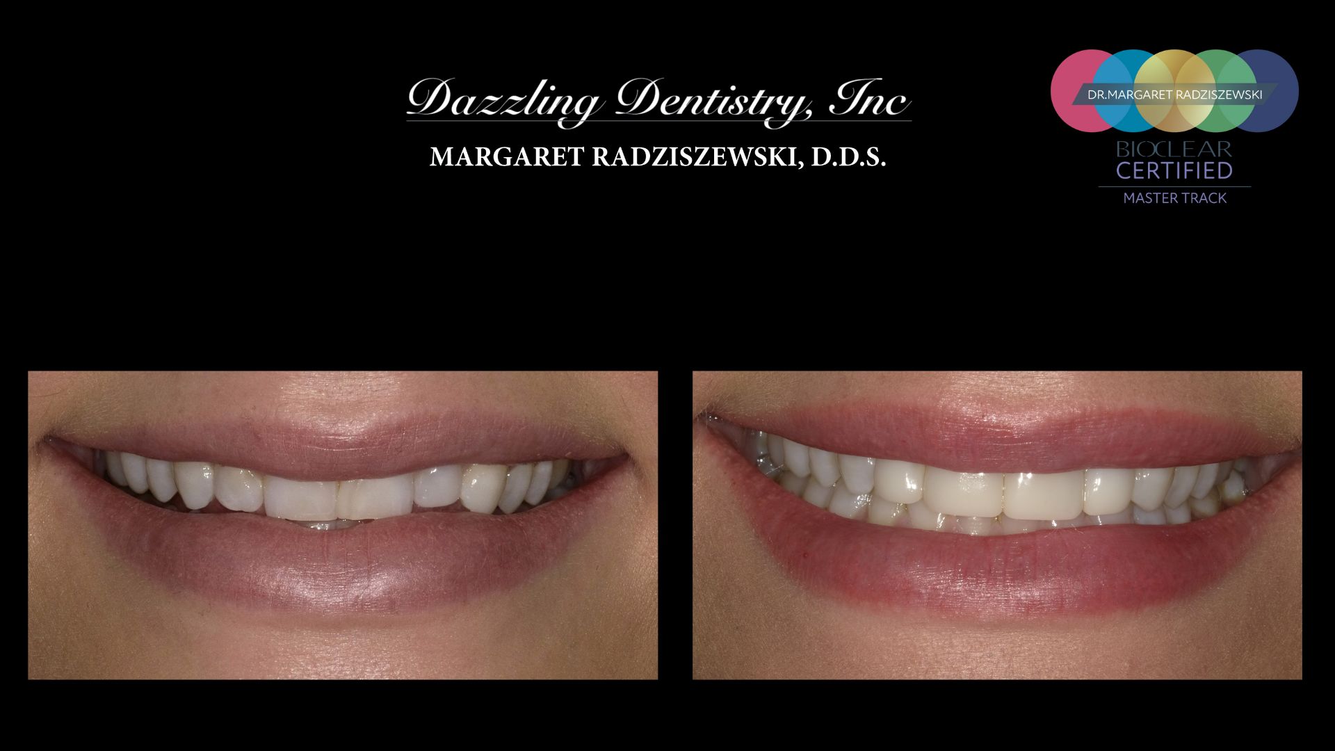 Bioclear