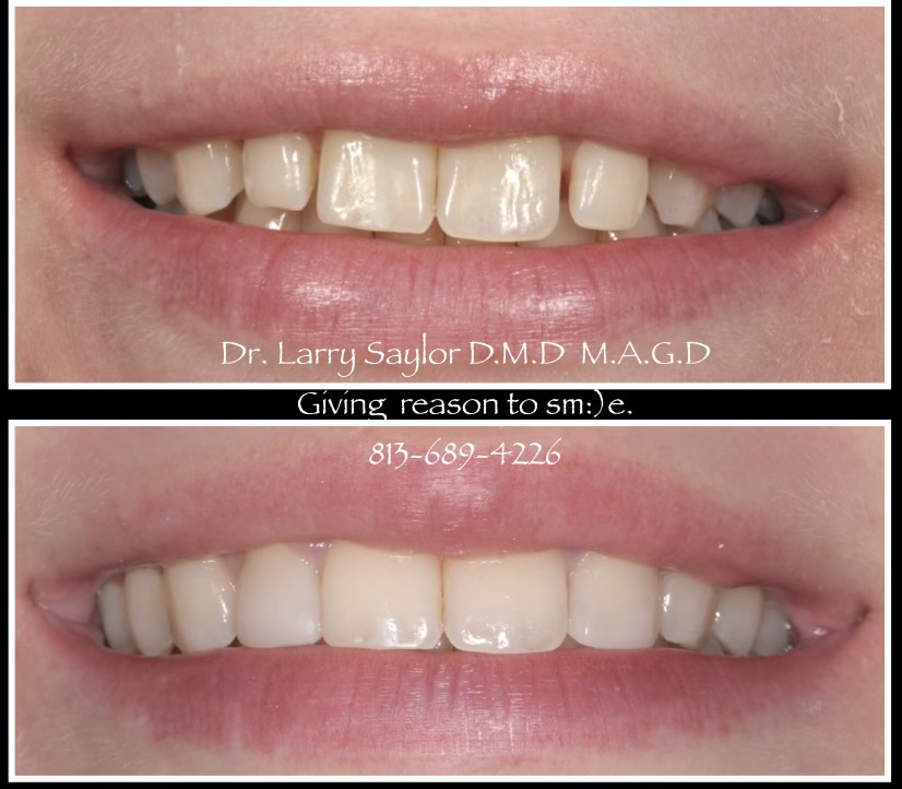 Bioclear