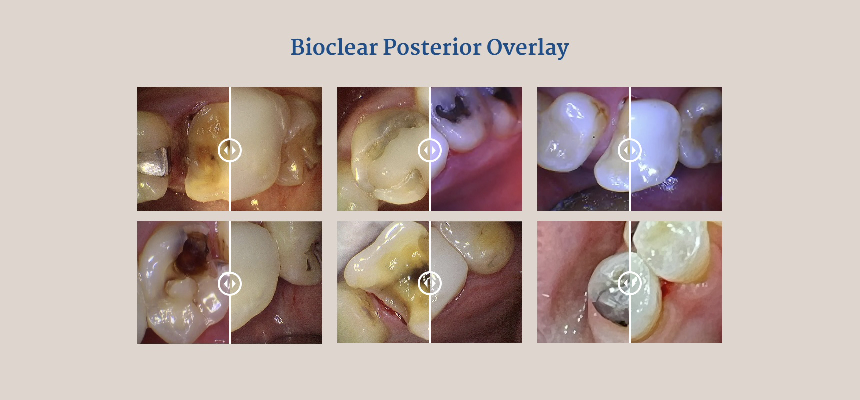 Bioclear