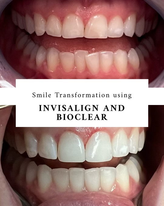 Bioclear