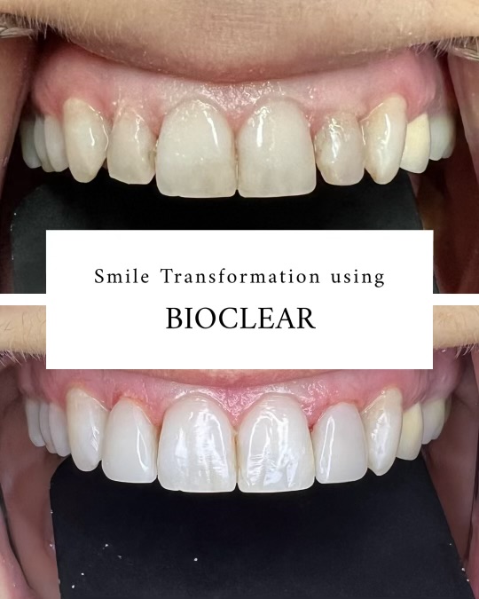 Bioclear