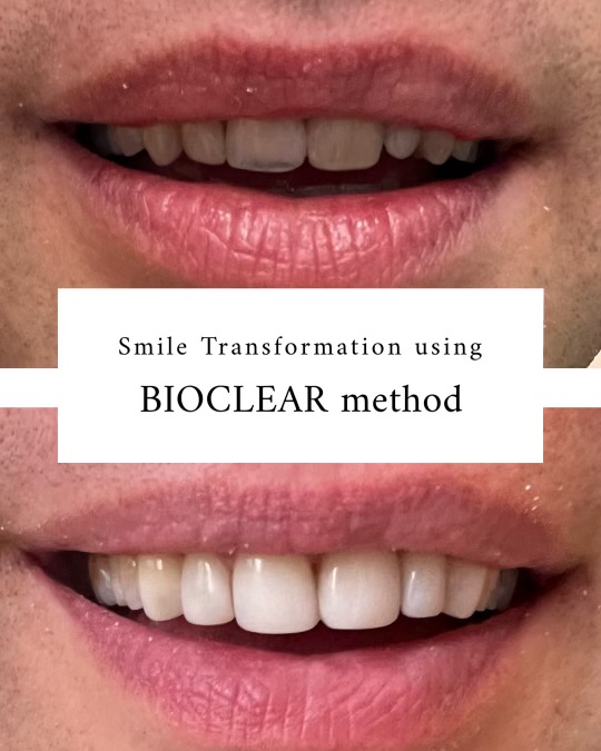 Bioclear