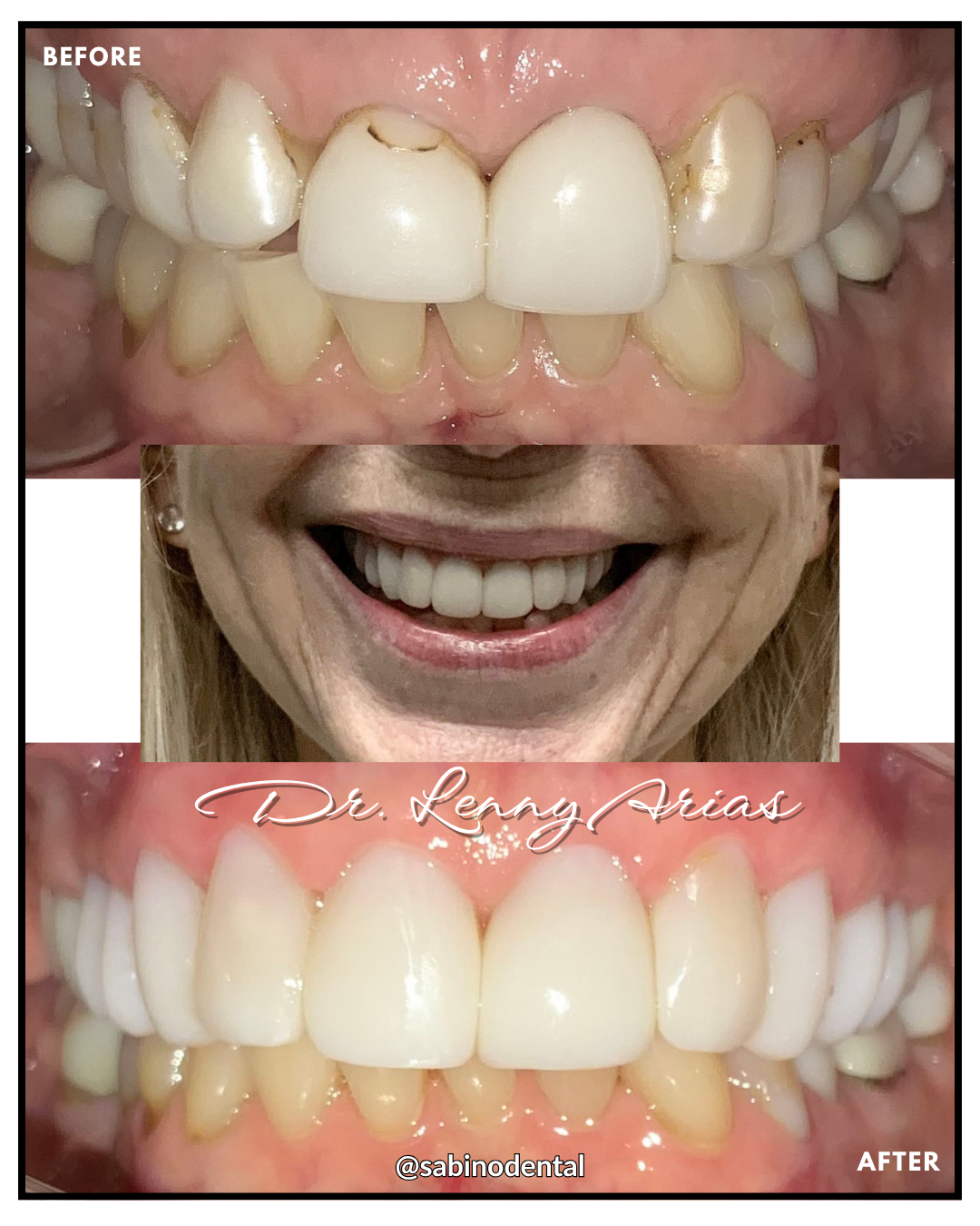 Bioclear
