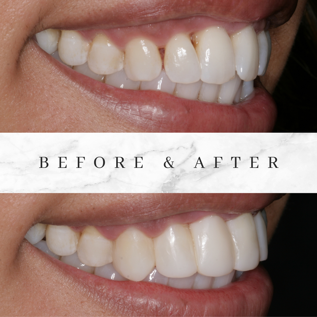 Bioclear