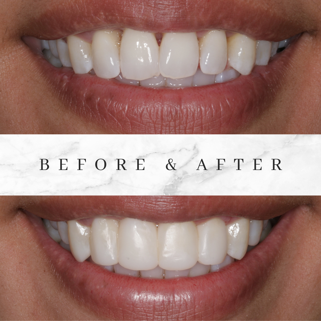 Bioclear