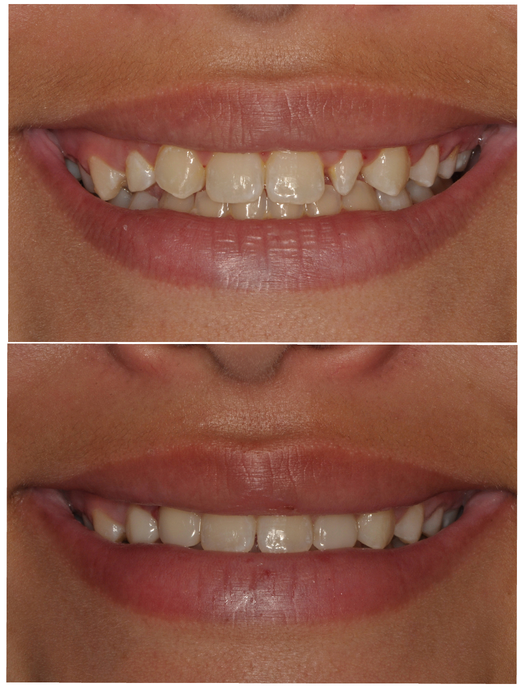Bioclear