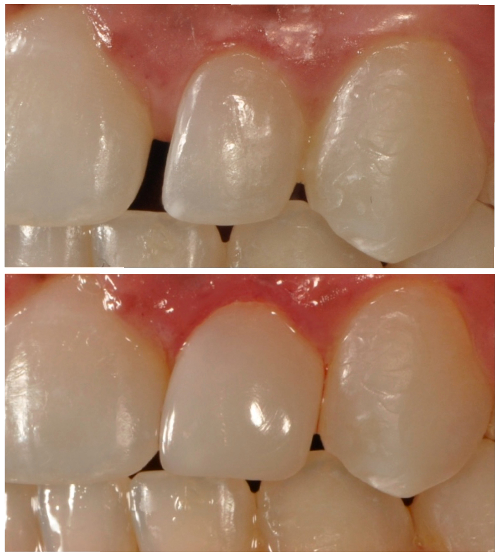 Bioclear