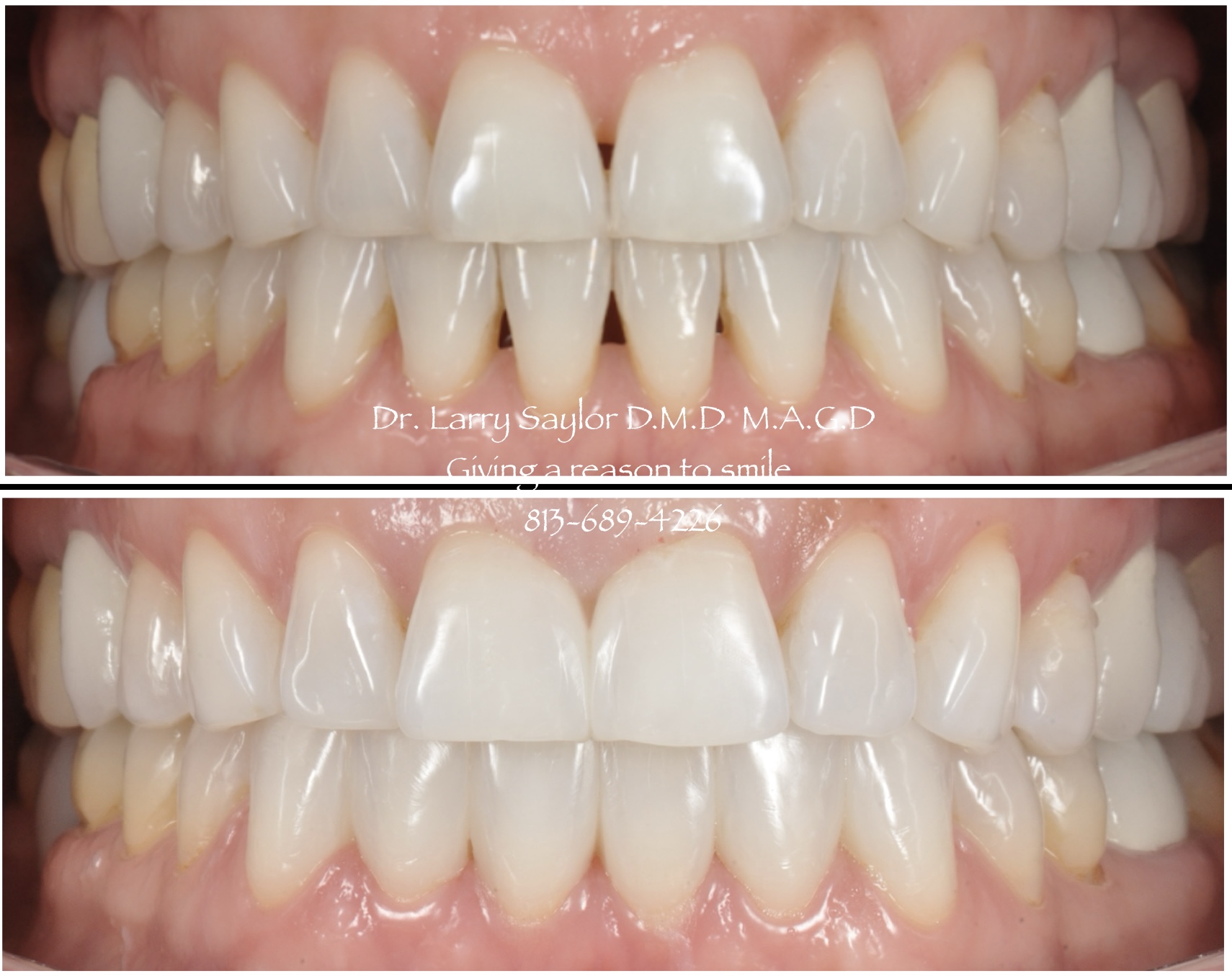 Bioclear