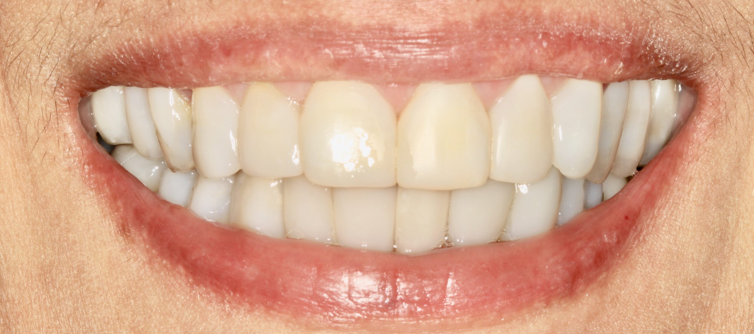 Bioclear